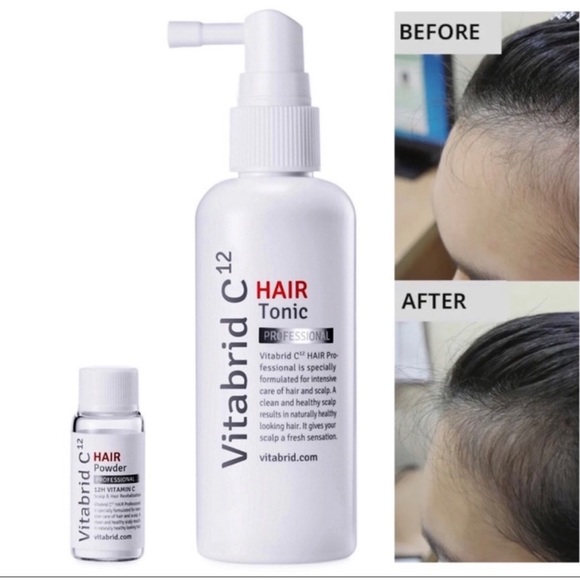 Vitabrid c12 Hair Tonic Set Professional, New in Box - Picture 5 of 7